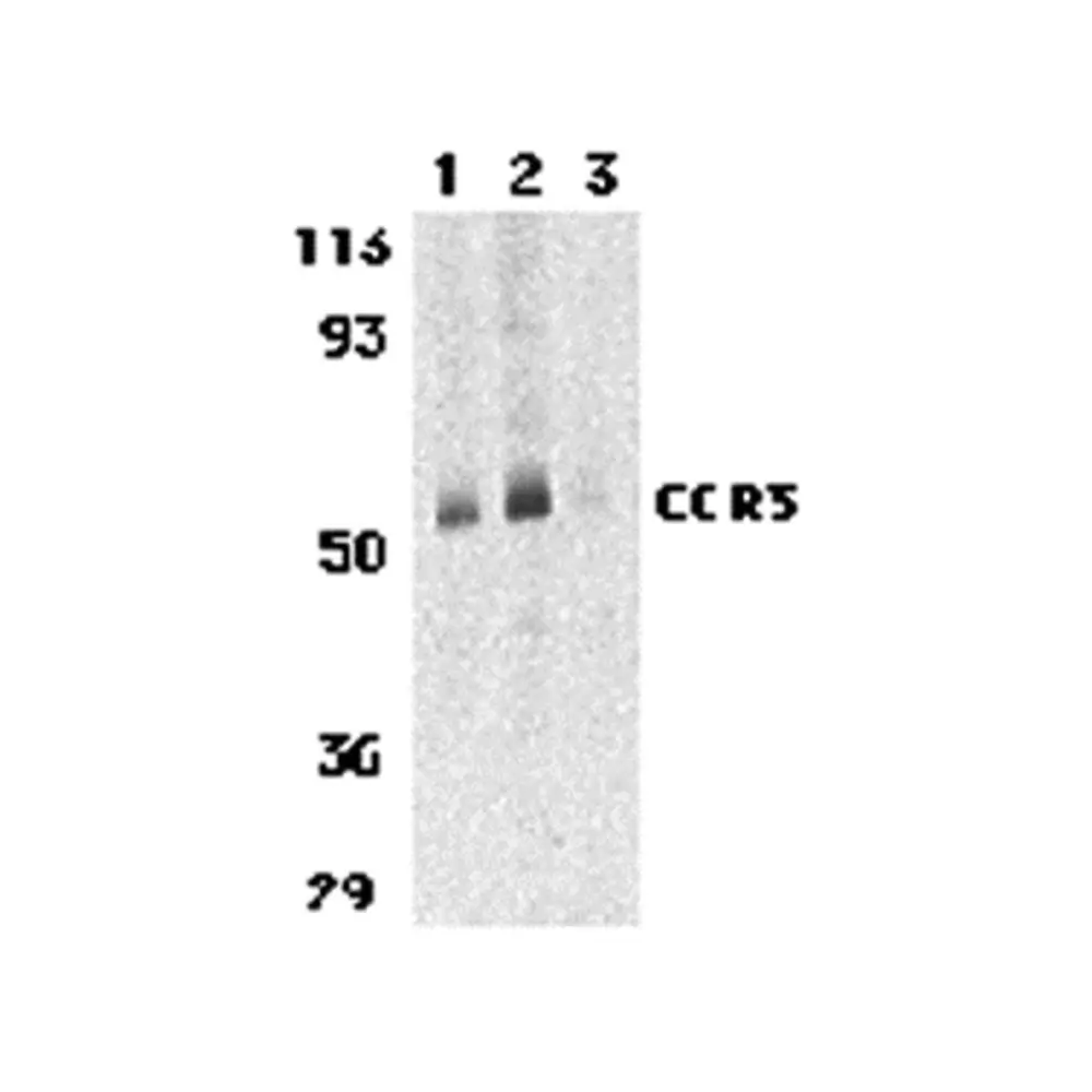 ProSci 1105 CCR3 Antibody, ProSci, 0.1 mg/Unit Primary Image