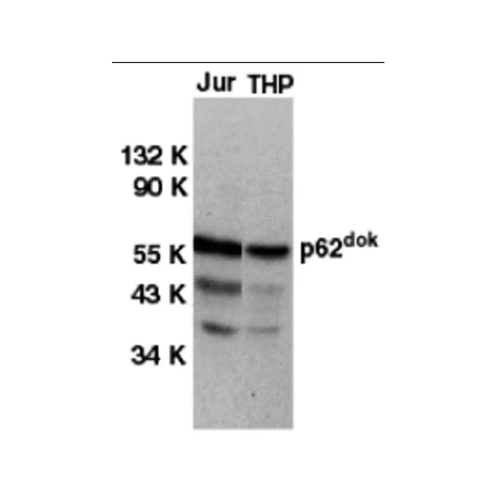 ProSci 1107 DOK1 Antibody, ProSci, 0.1 mg/Unit Primary Image