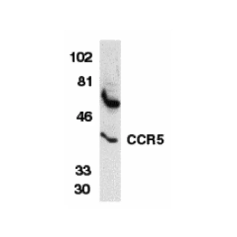 ProSci 1112 CCR5 Antibody, ProSci, 0.1 mg/Unit Primary Image