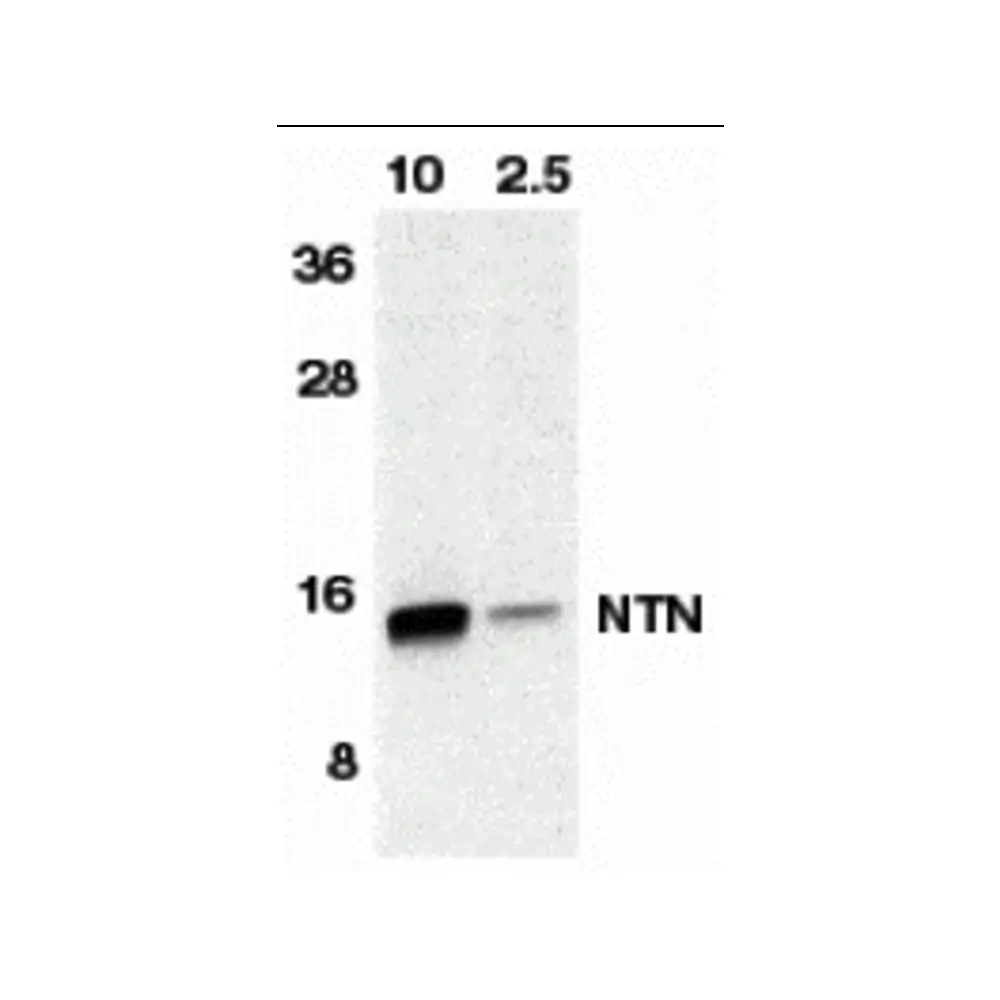 ProSci 1121_S Neurturin Antibody, ProSci, 0.02 mg/Unit Primary Image