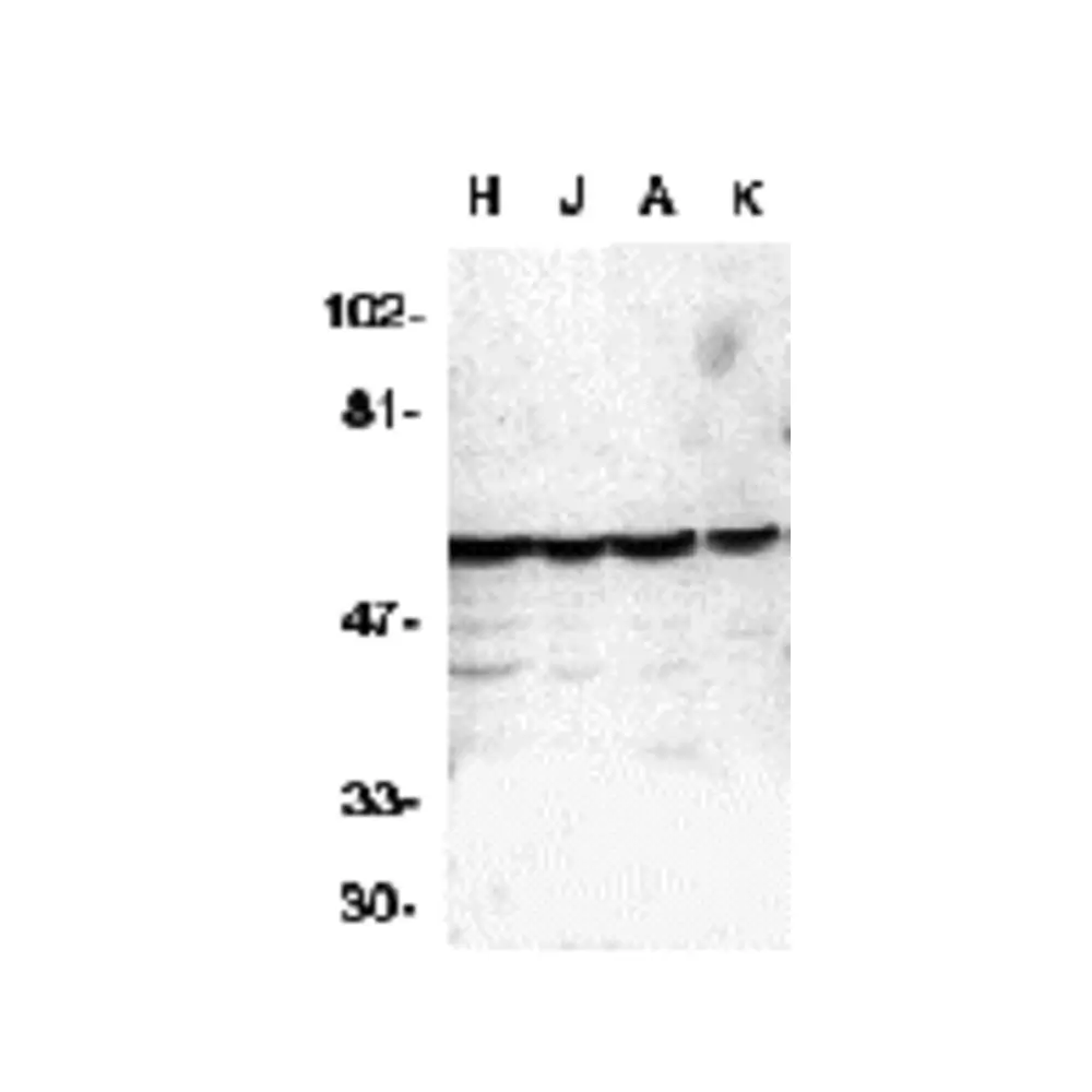 ProSci 1128_S Caspase-10 Antibody, ProSci, 0.02 mg/Unit Primary Image