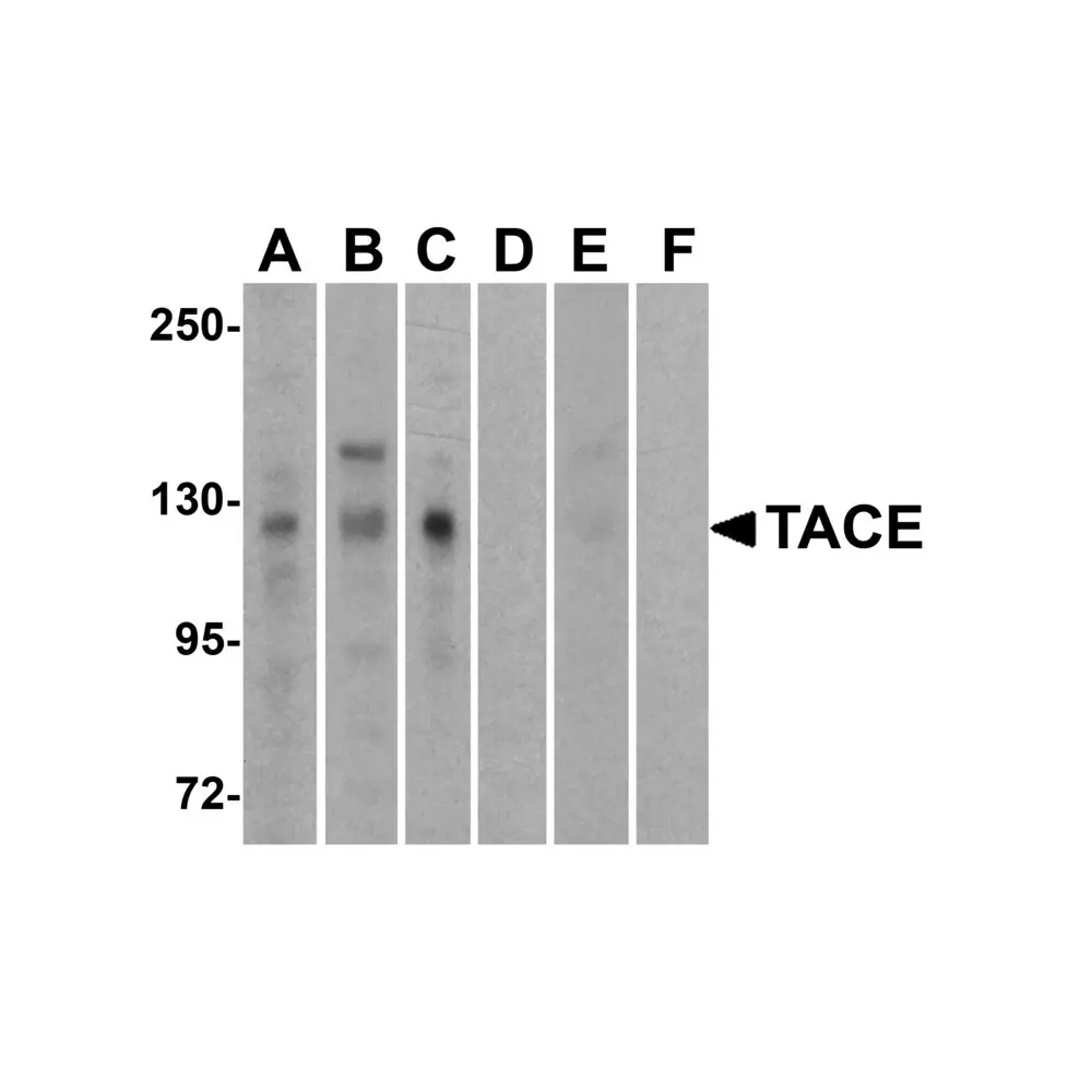 ProSci 1131 TACE Antibody, ProSci, 0.1 mg/Unit Primary Image