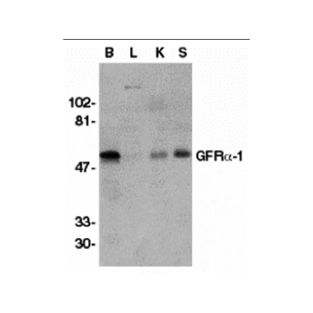 ProSci 1133 GFR alpha 1 Antibody, ProSci, 0.1 mg/Unit Primary Image