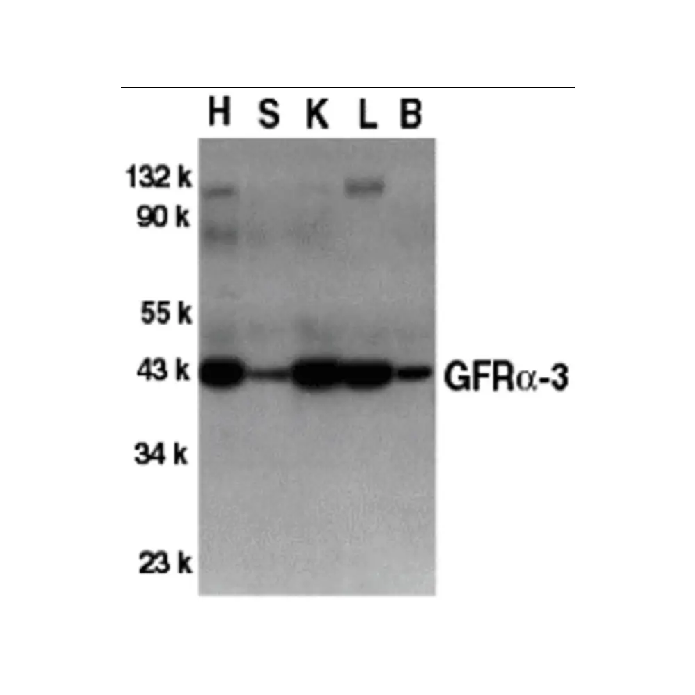 ProSci 1137 GFR alpha 3 Antibody, ProSci, 0.1 mg/Unit Primary Image