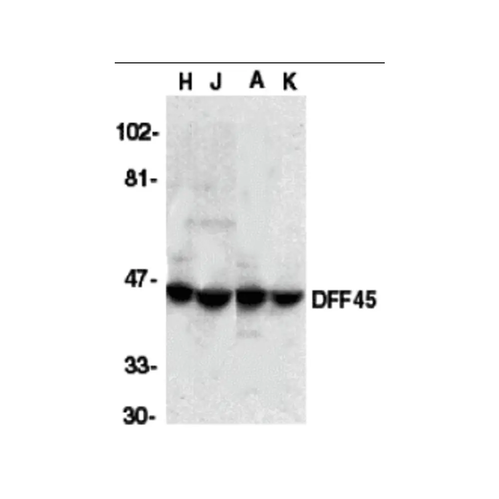 ProSci 1141 DFF45 Antibody, ProSci, 0.1 mg/Unit Primary Image