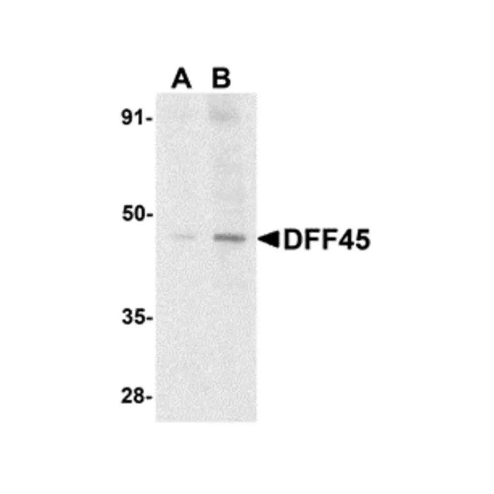 ProSci 1148 DFF45 Antibody, ProSci, 0.1 mg/Unit Primary Image