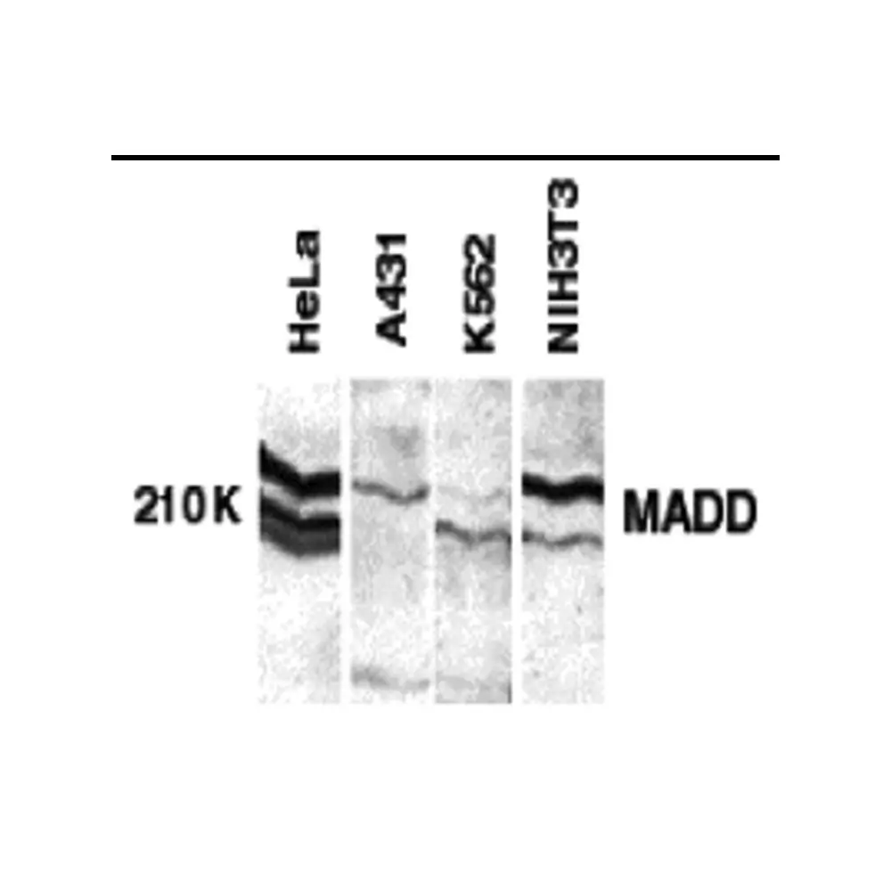 ProSci 1150_S MADD Antibody, ProSci, 0.02 mg/Unit Primary Image