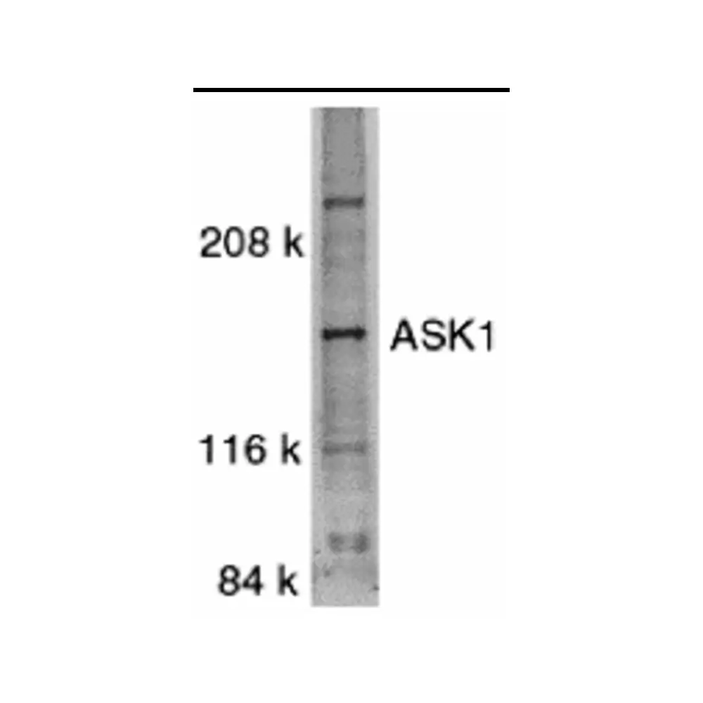 ProSci 1151 ASK1 Antibody, ProSci, 0.1 mg/Unit Primary Image