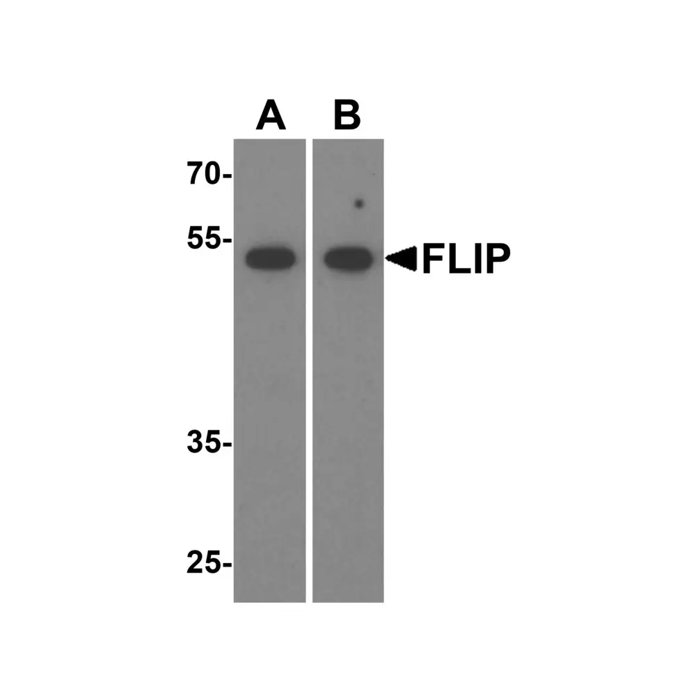 ProSci 1159 FLIP Antibody, ProSci, 0.1 mg/Unit Primary Image