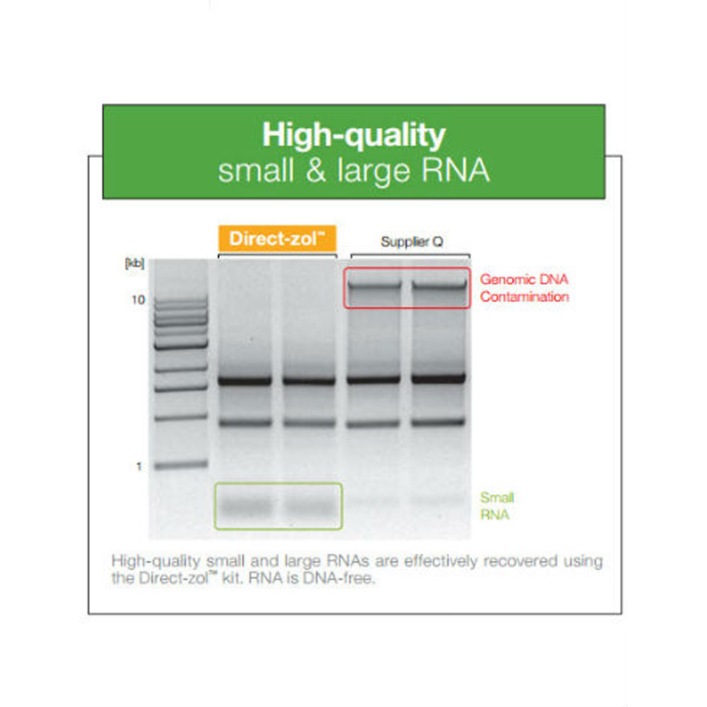 Direct Zol Rna Miniprep 50µg 11 331 Genesee Scientific