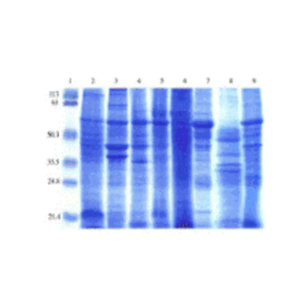 ProSci 1521 Human Normal Tissue Blot I, ProSci, One blot/Unit Primary Image