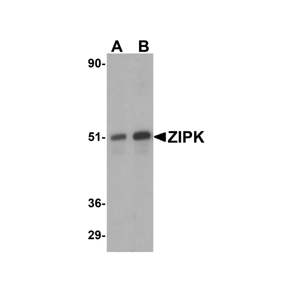 ProSci 2067_S ZIPK Antibody, ProSci, 0.02 mg/Unit Primary Image