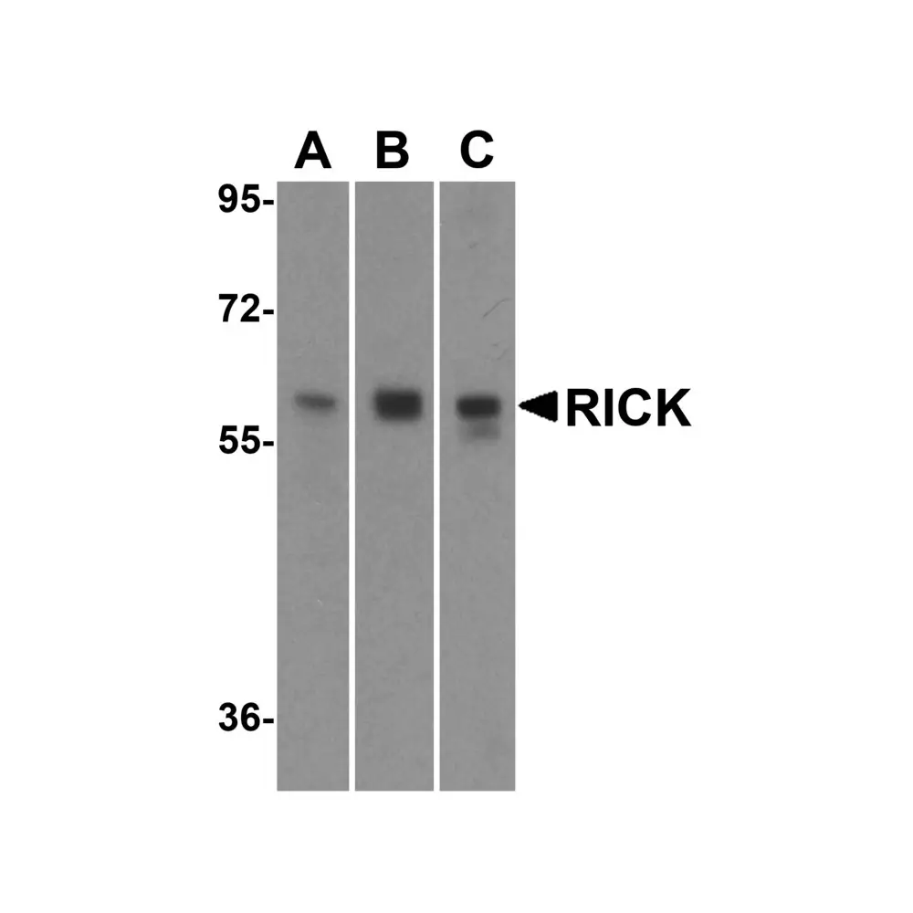 ProSci 2075_S RICK Antibody, ProSci, 0.02 mg/Unit Primary Image
