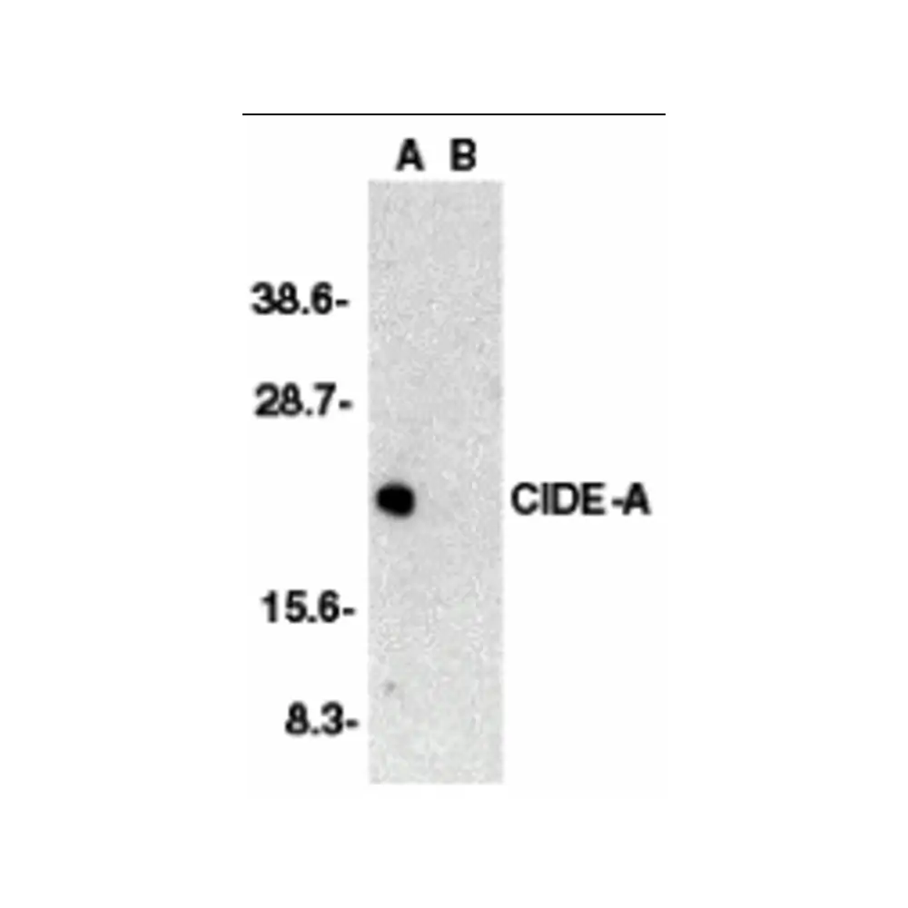ProSci 2085_S CIDE-A Antibody, ProSci, 0.02 mg/Unit Primary Image