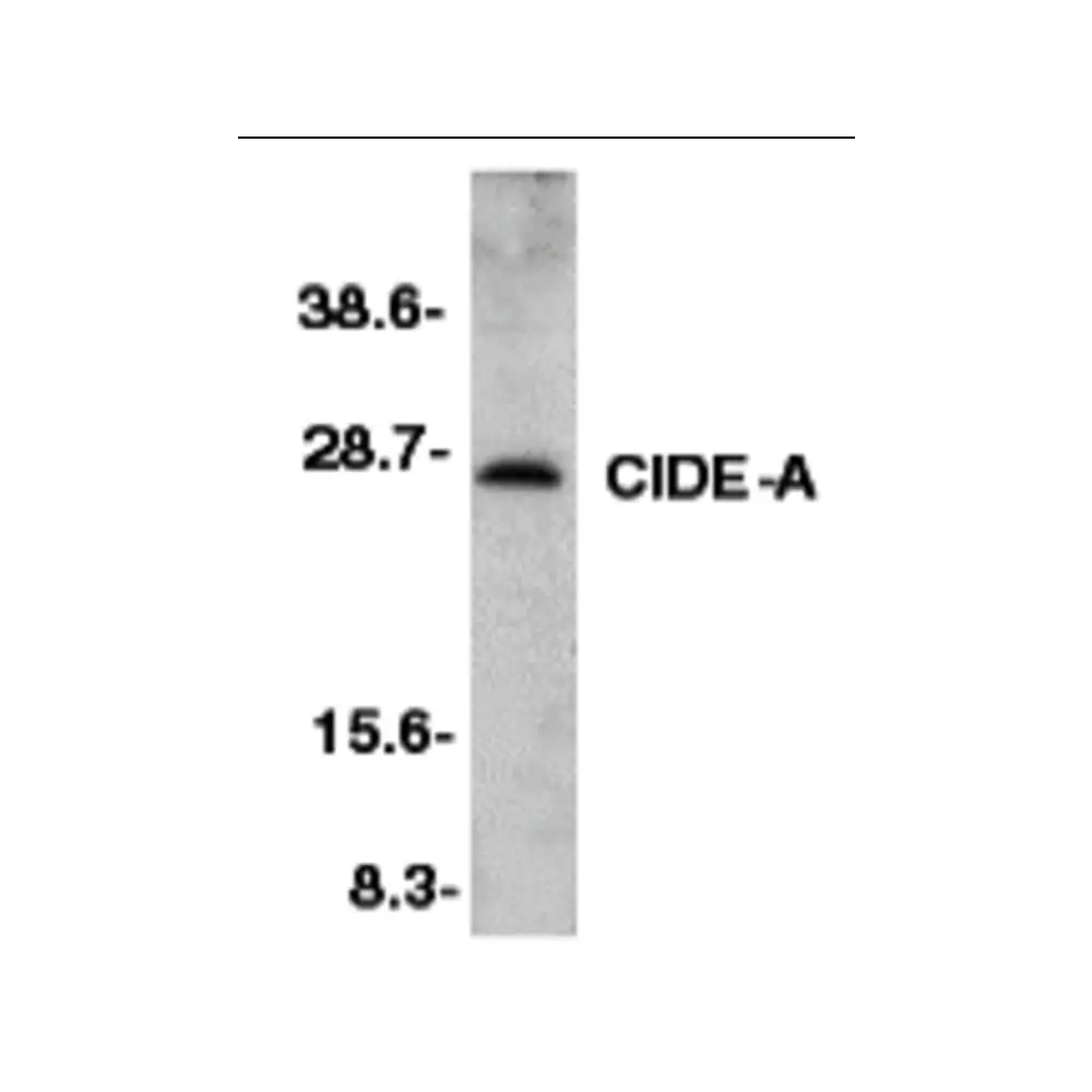 ProSci 2089_S CIDE-A Antibody, ProSci, 0.02 mg/Unit Primary Image
