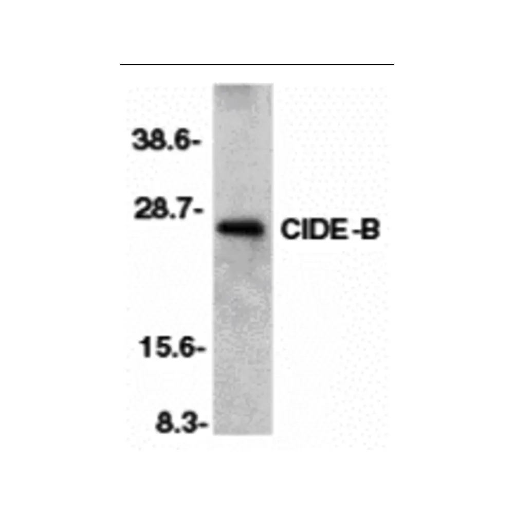 ProSci 2091 CIDE-B Antibody, ProSci, 0.1 mg/Unit Primary Image