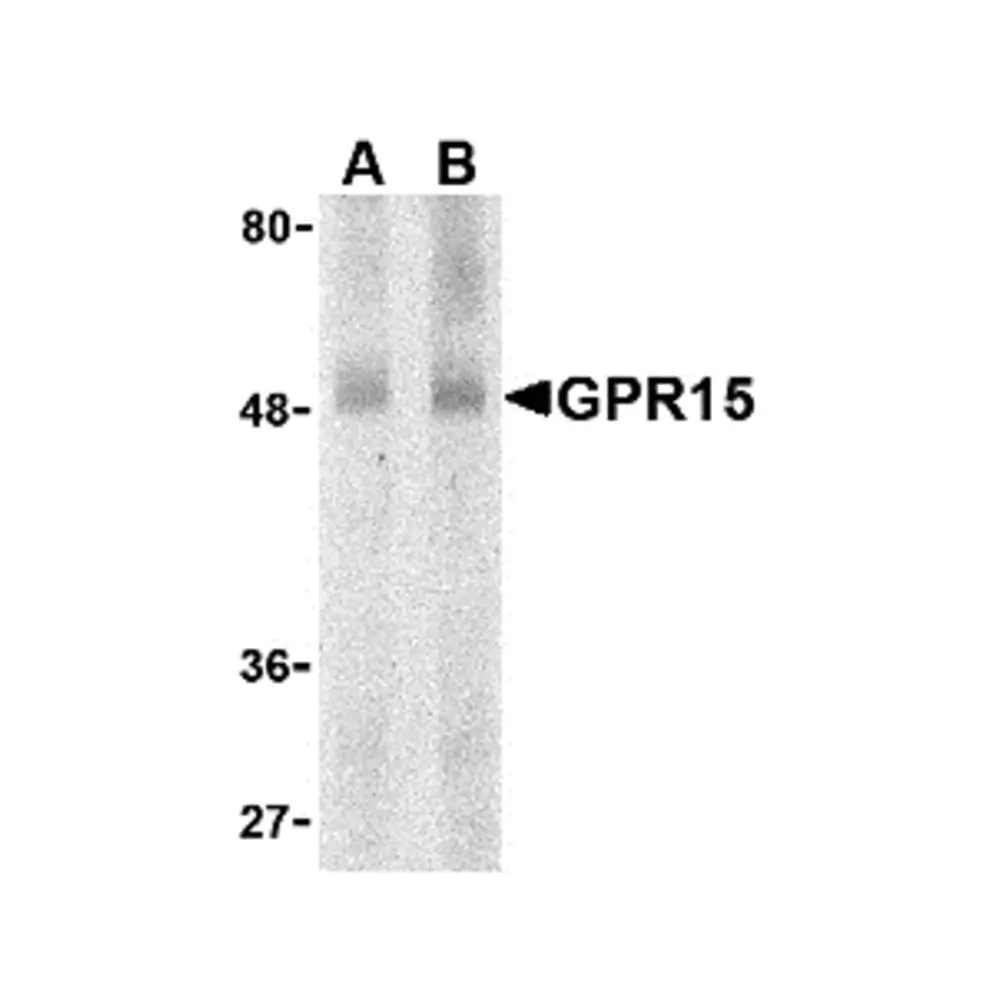 ProSci 2101_S GPR15 Antibody, ProSci, 0.02 mg/Unit Primary Image