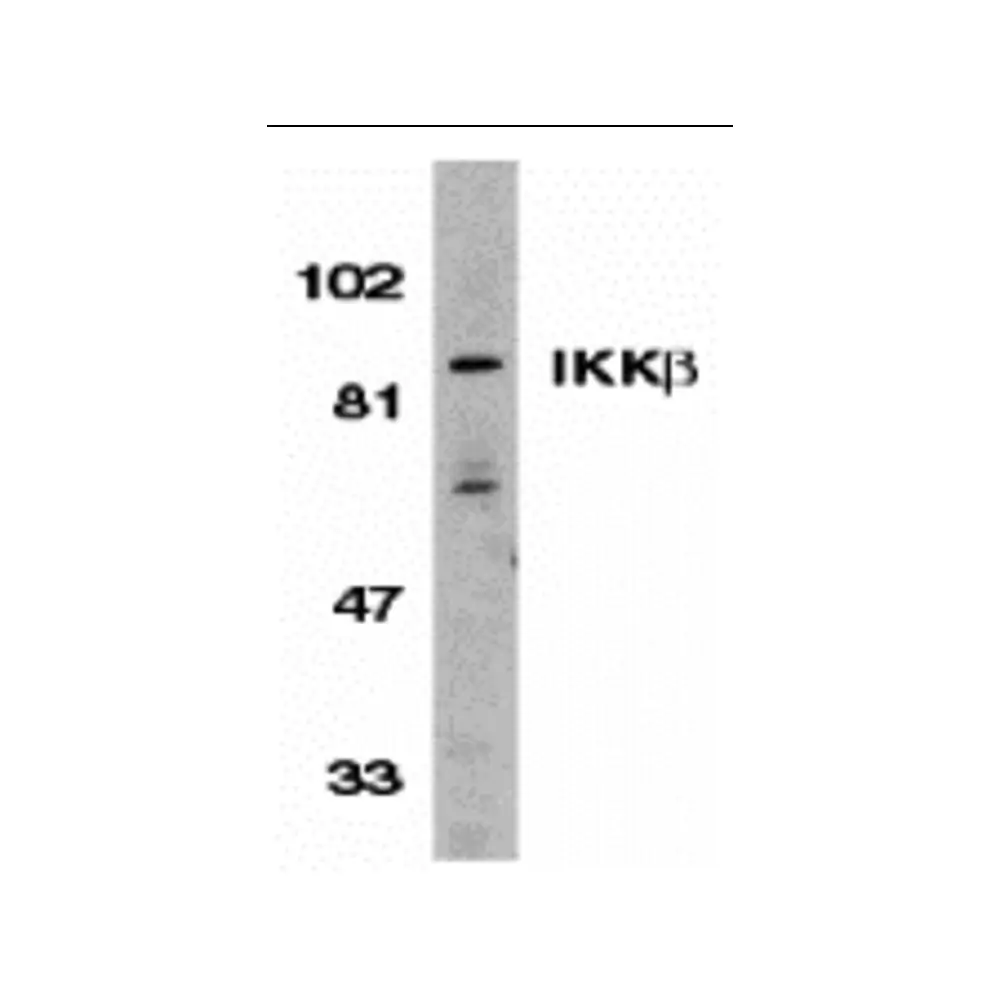 ProSci 2121 IKK beta Antibody, ProSci, 0.1 mg/Unit Primary Image
