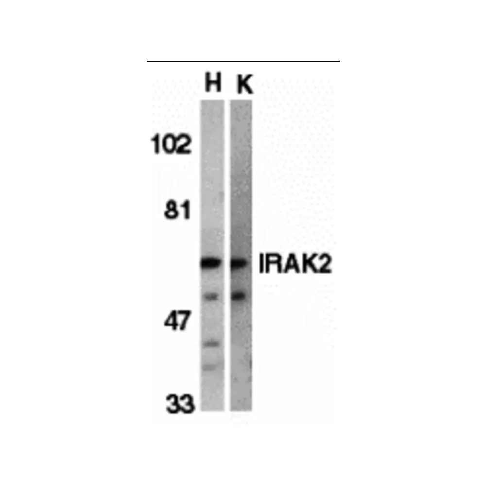 ProSci 2123 IRAK-2 Antibody, ProSci, 0.1 mg/Unit Primary Image