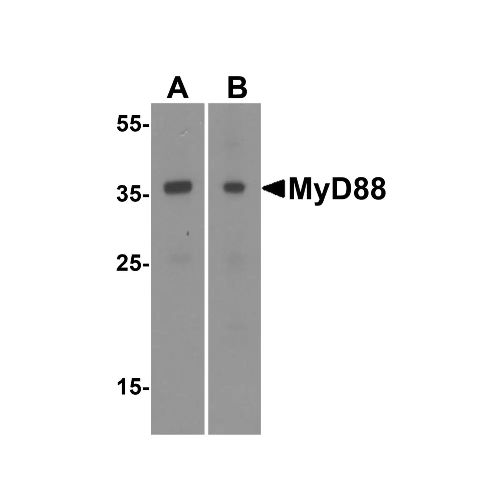 ProSci 2125 MYD88 Antibody, ProSci, 0.1 mg/Unit Primary Image