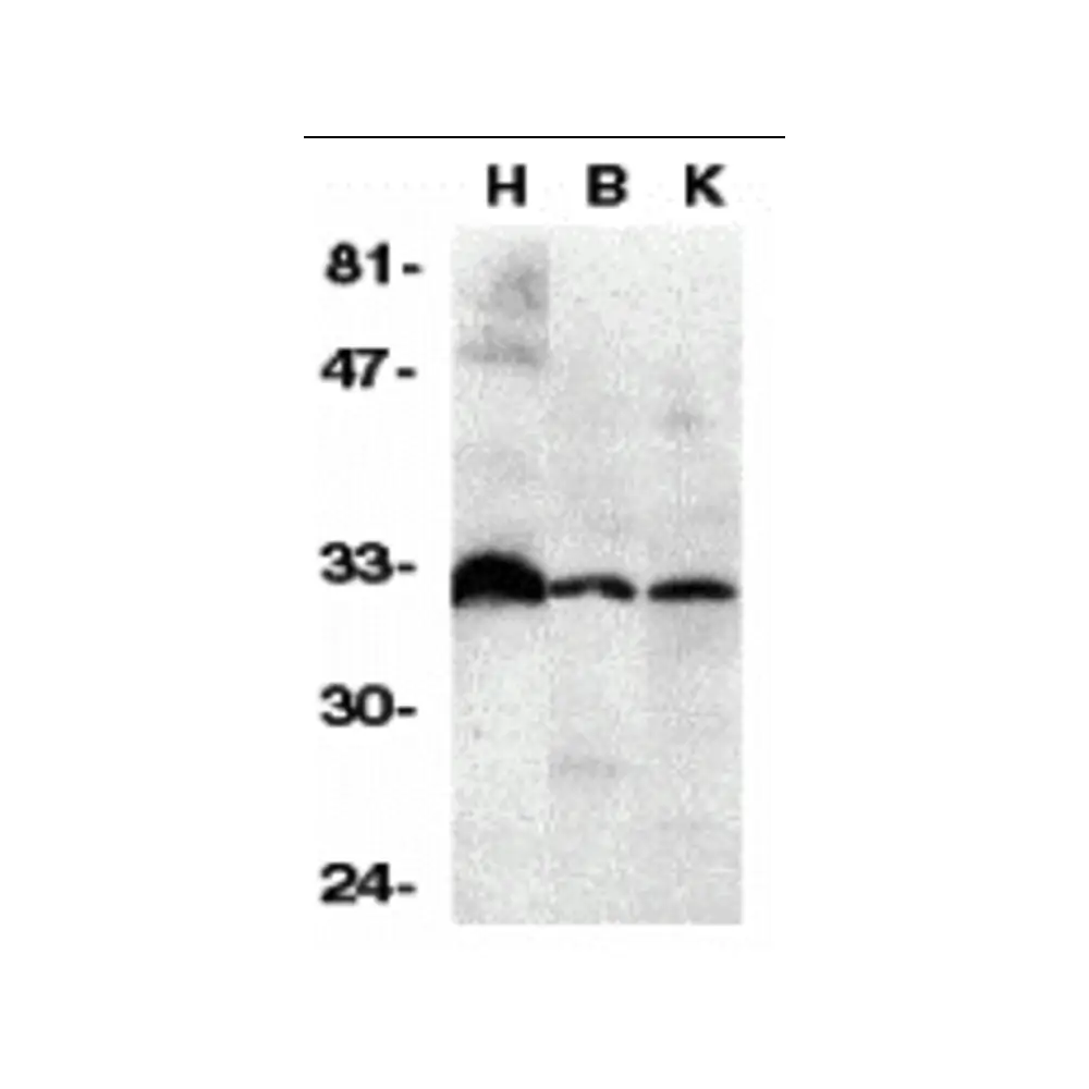 ProSci 2140_S DcR3 Antibody, ProSci, 0.02 mg/Unit Primary Image