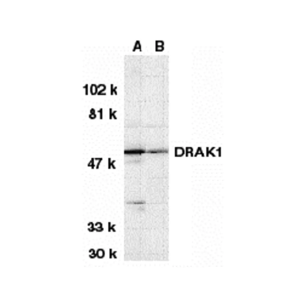 ProSci 2147 DRAK1 Antibody, ProSci, 0.1 mg/Unit Primary Image