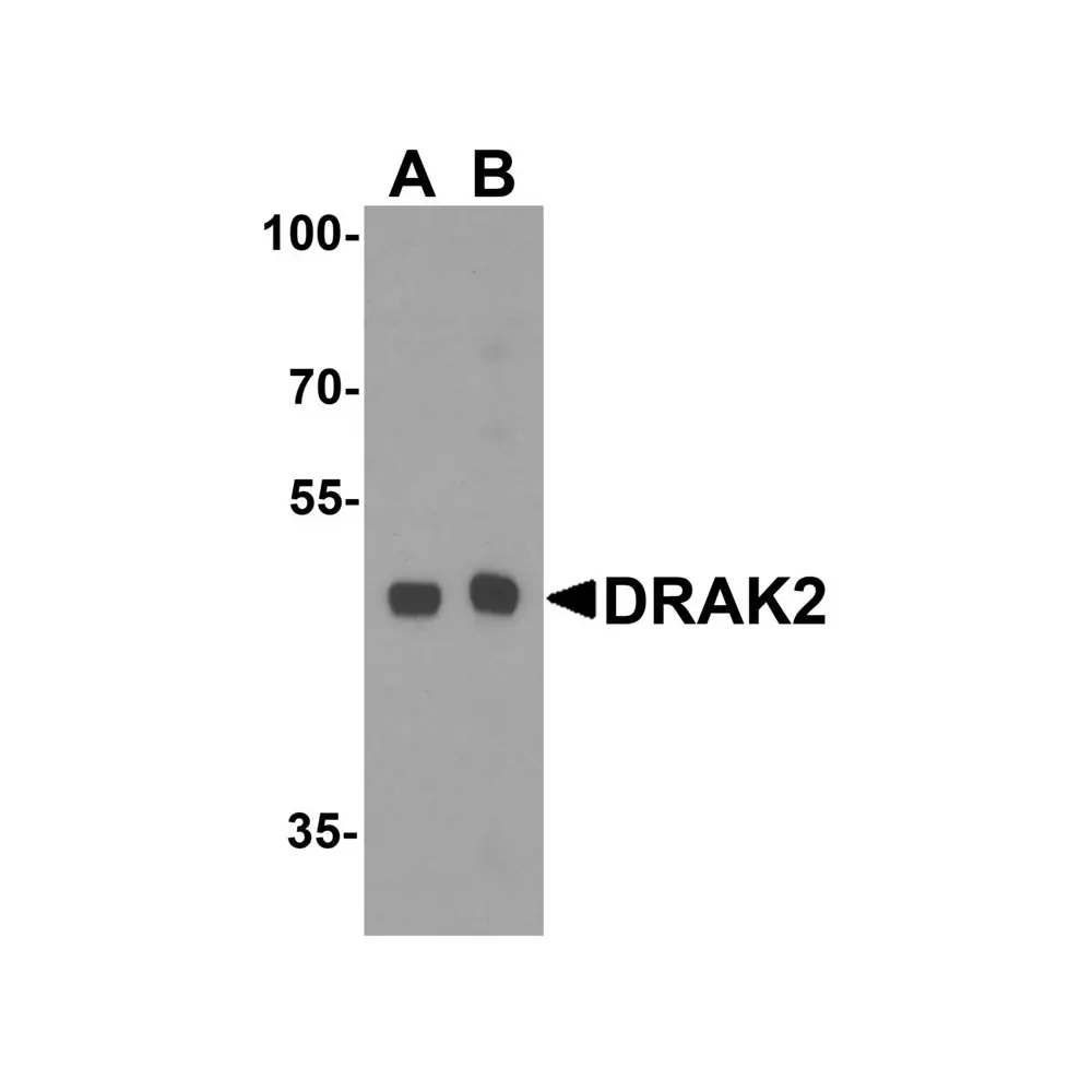 ProSci 2149_S DRAK2 Antibody, ProSci, 0.02 mg/Unit Primary Image
