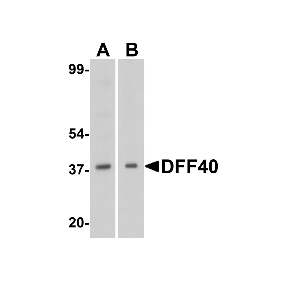 ProSci 2155_S DFF40 Antibody, ProSci, 0.02 mg/Unit Primary Image
