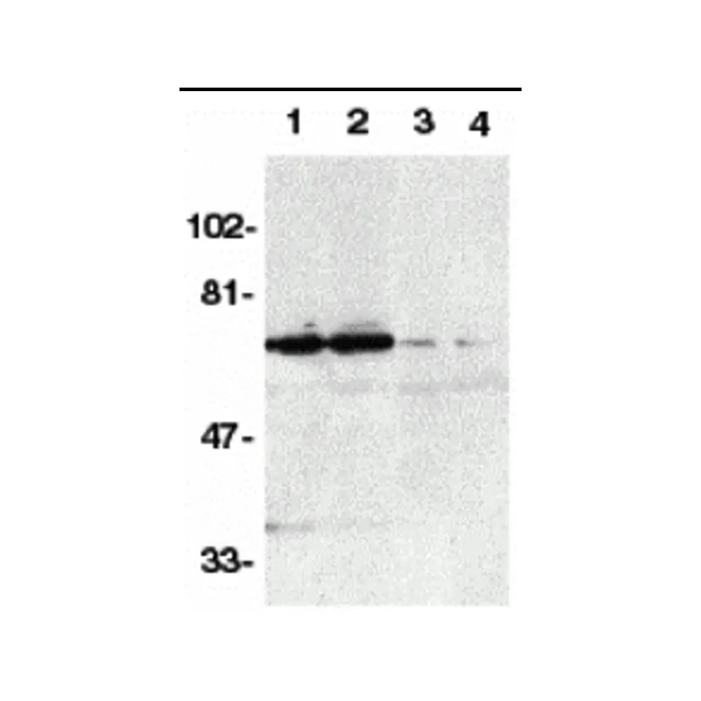 ProSci 2157 DR6 Antibody, ProSci, 0.1 mg/Unit Primary Image