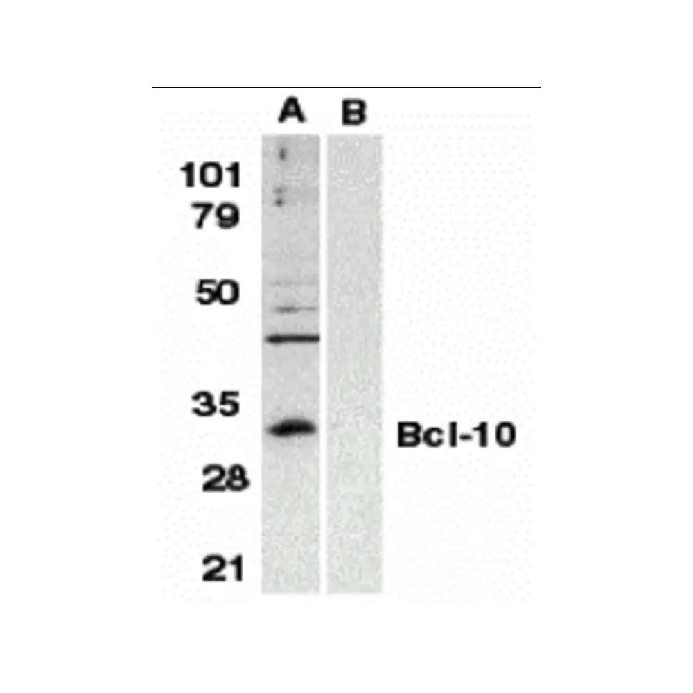 ProSci 2161 Bcl-10 Antibody, ProSci, 0.1 mg/Unit Primary Image