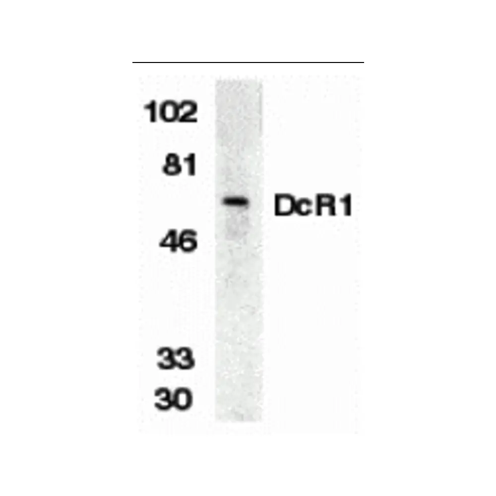 ProSci 2179 DcR1 Antibody, ProSci, 0.1 mg/Unit Primary Image