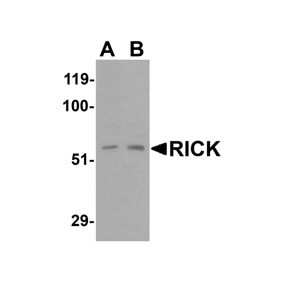 ProSci 2183_S RICK Antibody, ProSci, 0.02 mg/Unit Primary Image