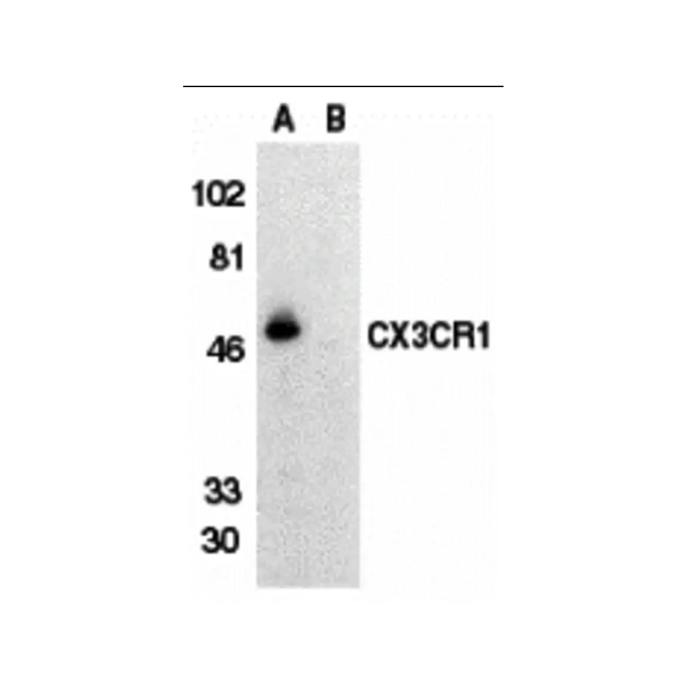 ProSci 2201 CX3CR1 Antibody, ProSci, 0.1 mg/Unit Primary Image