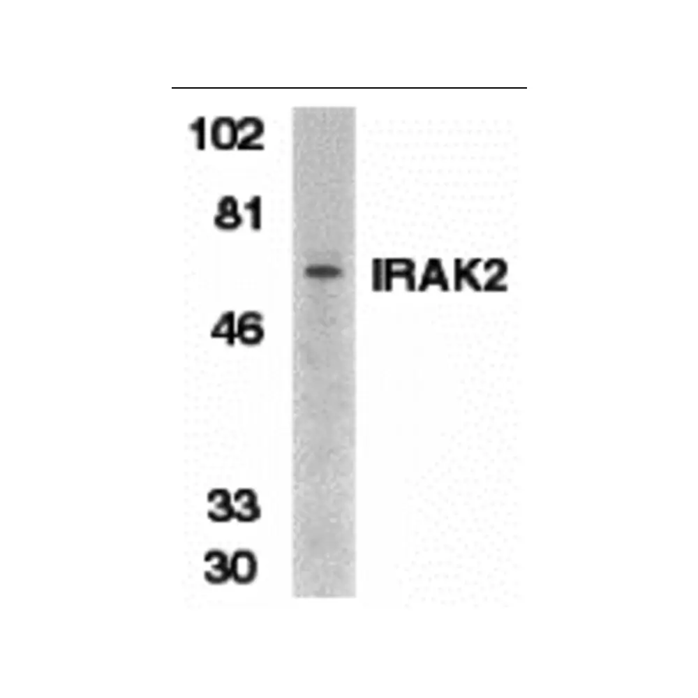 ProSci 2213 IRAK-2 Antibody, ProSci, 0.1 mg/Unit Primary Image