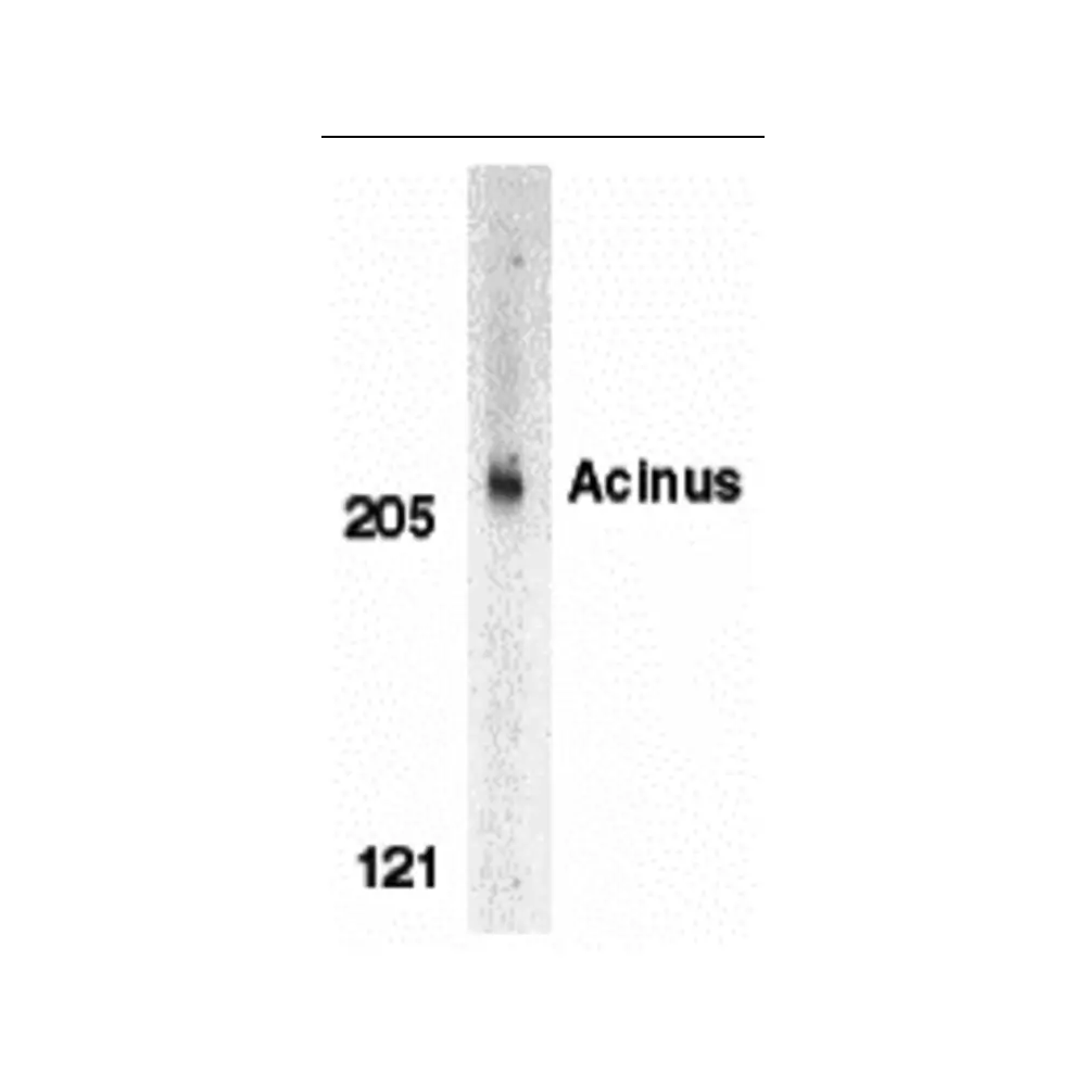 ProSci 2215 Acinus Antibody, ProSci, 0.1 mg/Unit Primary Image