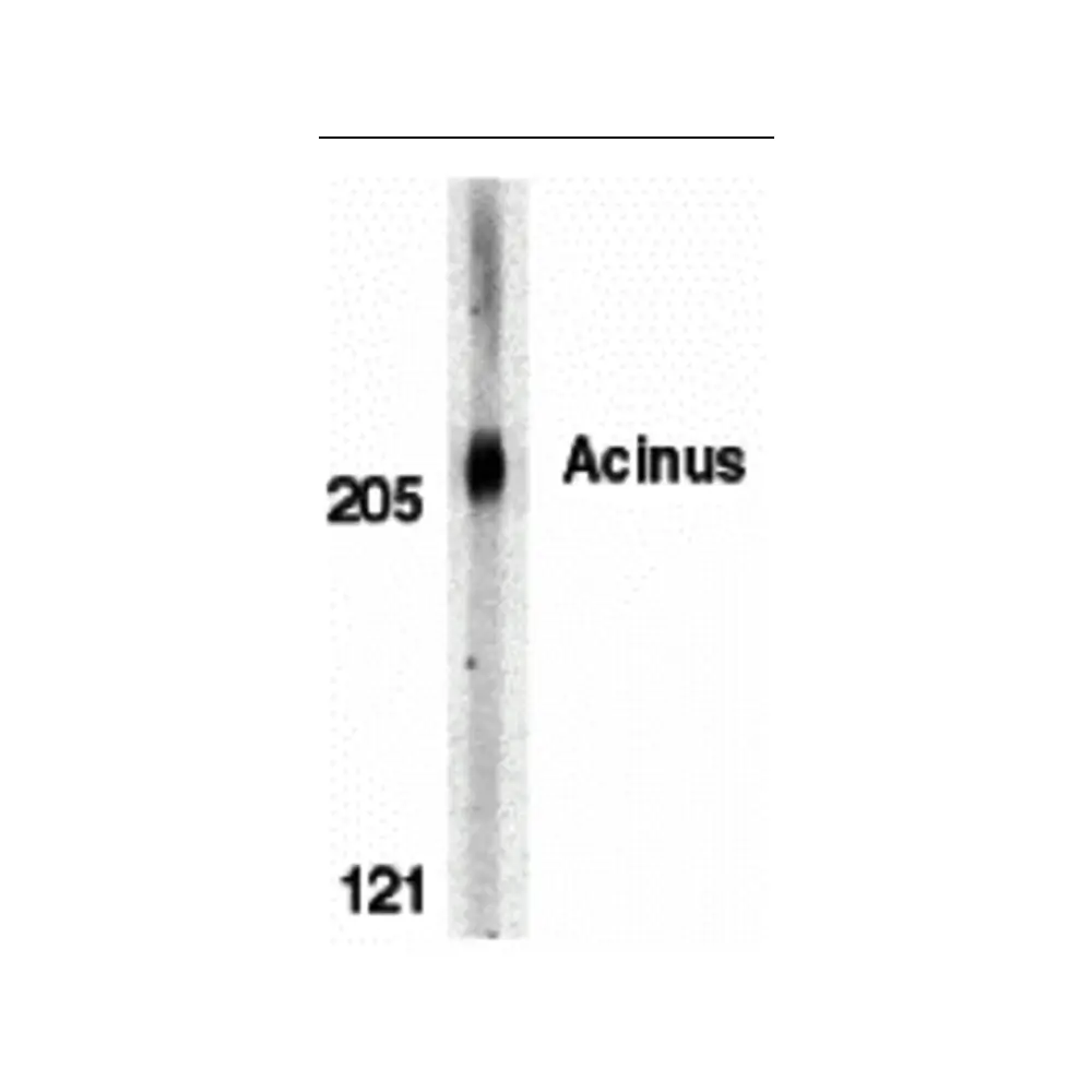 ProSci 2217_S Acinus Antibody, ProSci, 0.02 mg/Unit Primary Image