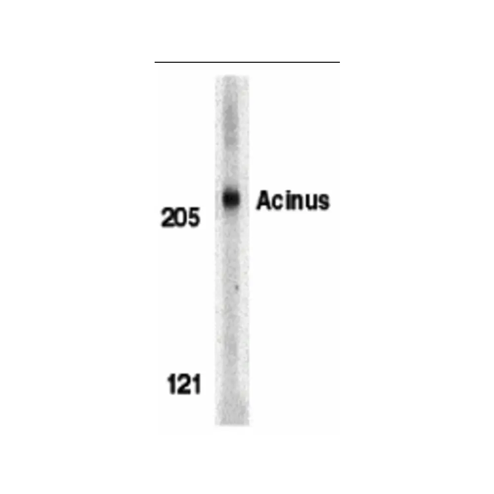 ProSci 2219 Acinus Antibody, ProSci, 0.1 mg/Unit Primary Image