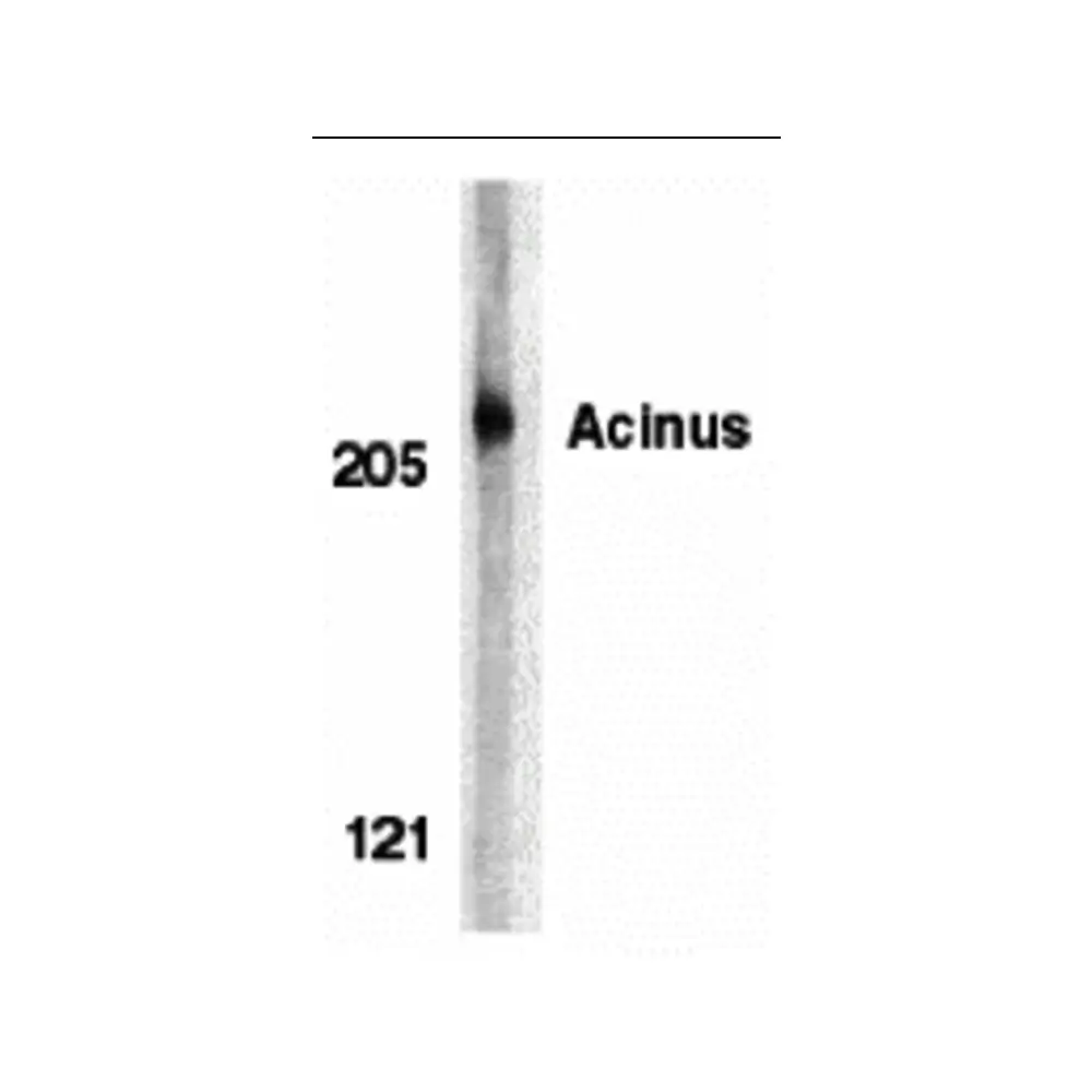 ProSci 2241_S Acinus Antibody, ProSci, 0.02 mg/Unit Primary Image