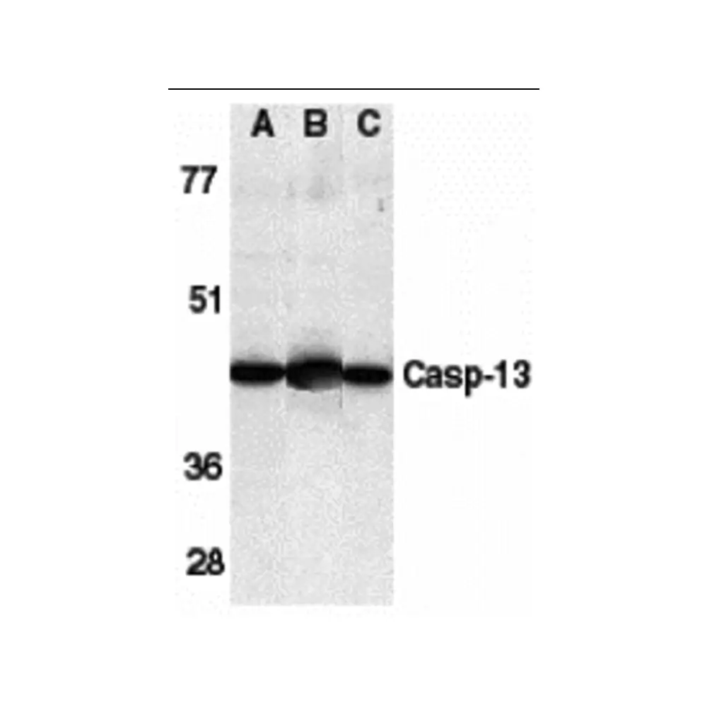 ProSci 2245_S Caspase-13 Antibody, ProSci, 0.02 mg/Unit Primary Image