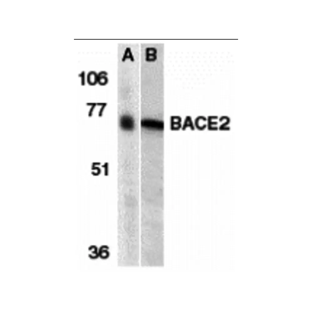 ProSci 2247_S BACE2 Antibody, ProSci, 0.02 mg/Unit Primary Image