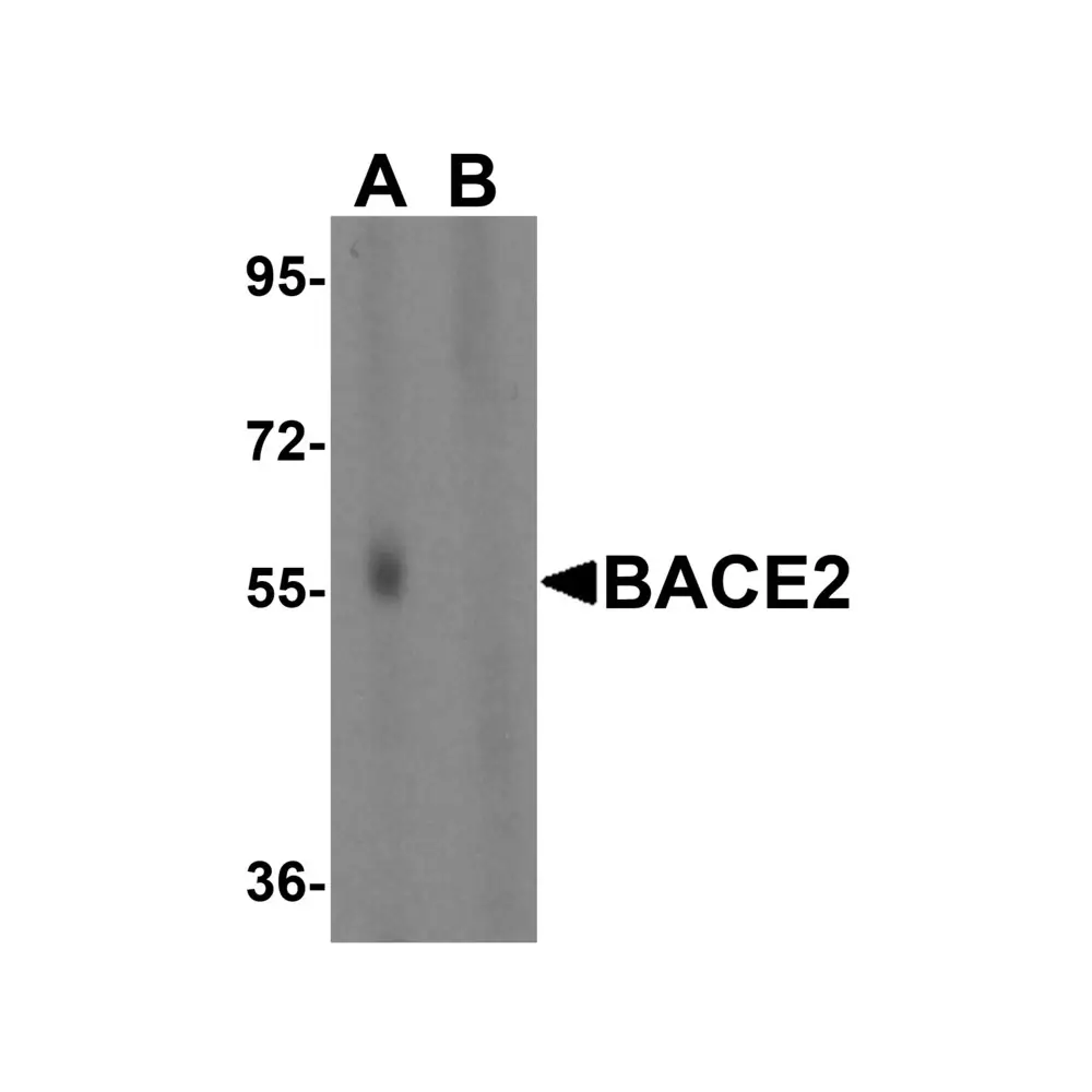 ProSci 2249 BACE2 Antibody, ProSci, 0.1 mg/Unit Primary Image