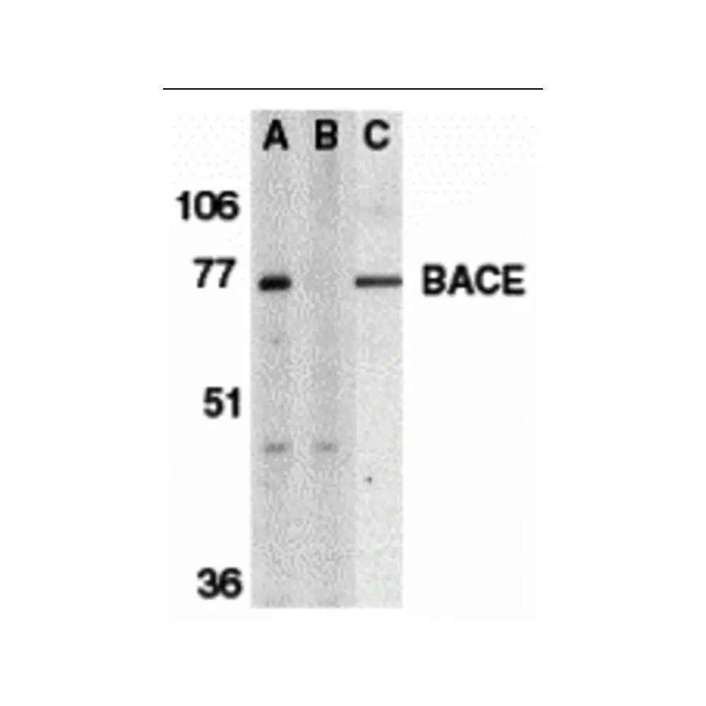 ProSci 2253_S BACE Antibody, ProSci, 0.02 mg/Unit Primary Image