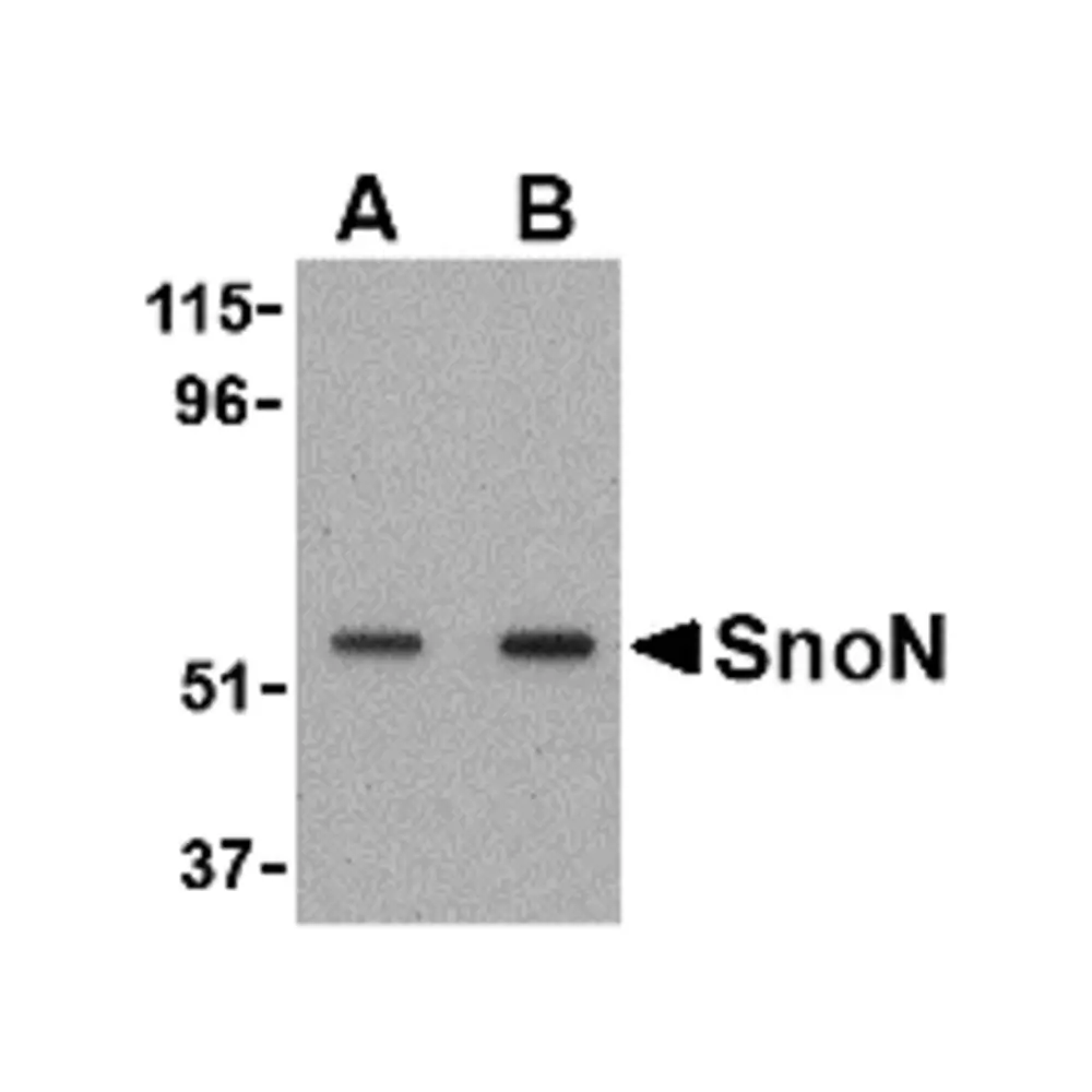 ProSci 2255 SnoN Antibody, ProSci, 0.1 mg/Unit Primary Image