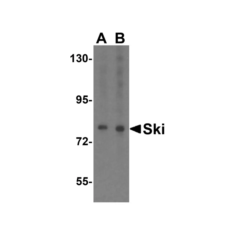 ProSci 2259_S Ski Antibody, ProSci, 0.02 mg/Unit Primary Image