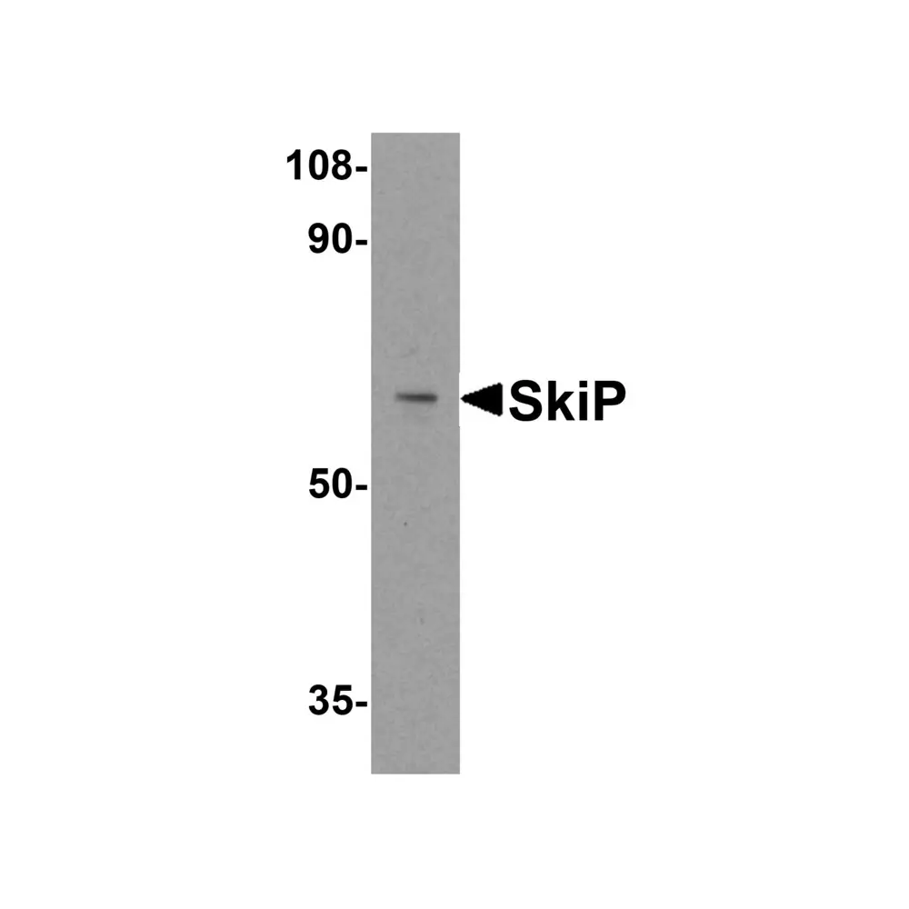 ProSci 2261 SkiP Antibody, ProSci, 0.1 mg/Unit Primary Image