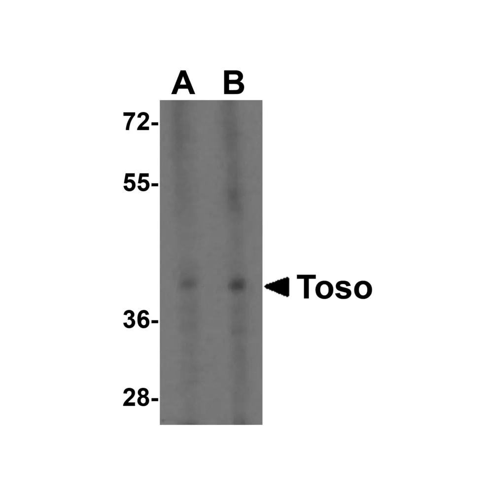 ProSci 2273 Toso Antibody, ProSci, 0.1 mg/Unit Primary Image