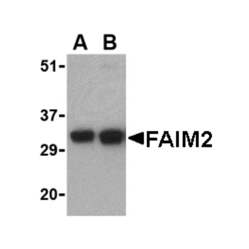 ProSci 2285_S FAIM2 Antibody, ProSci, 0.02 mg/Unit Primary Image