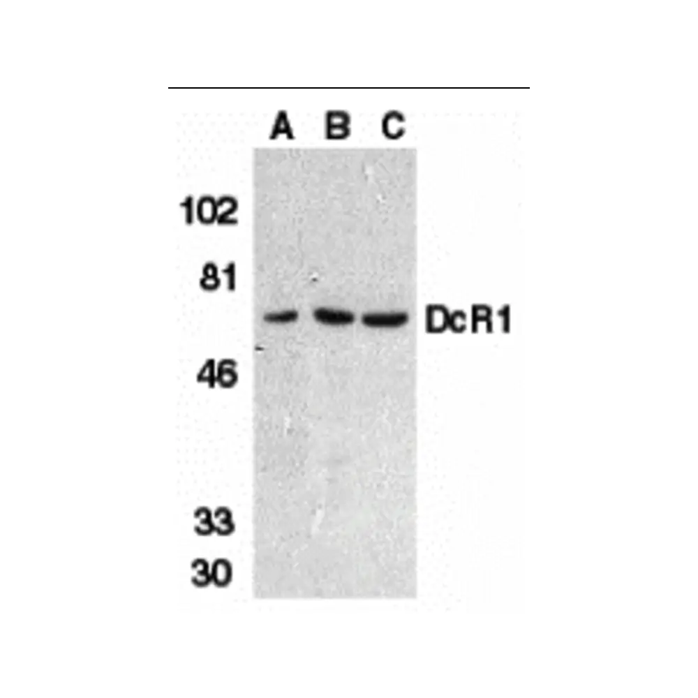 ProSci 2299 DcR1 Antibody, ProSci, 0.1 mg/Unit Primary Image