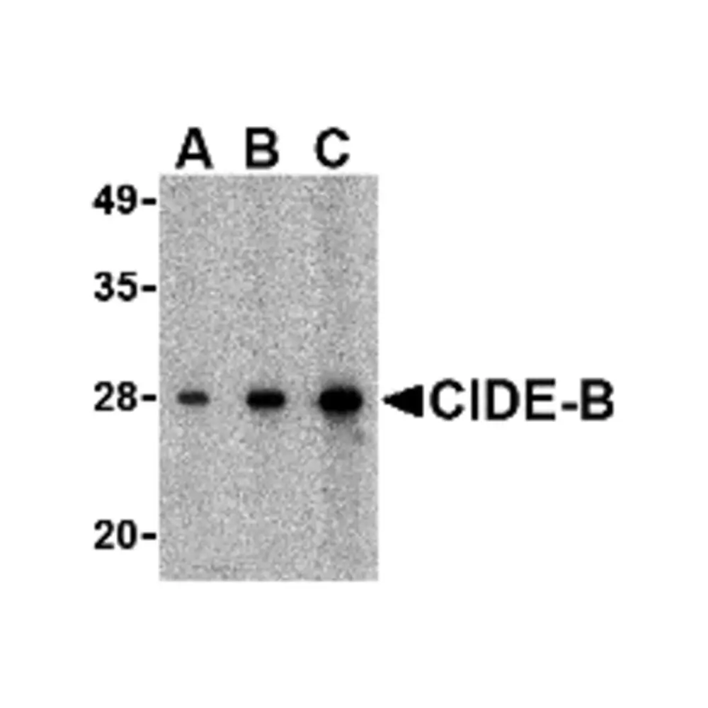 ProSci 2319_S CIDE-B Antibody, ProSci, 0.02 mg/Unit Primary Image
