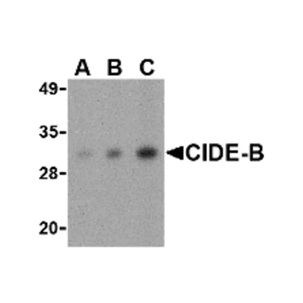 ProSci 2321 CIDE-B Antibody, ProSci, 0.1 mg/Unit Primary Image